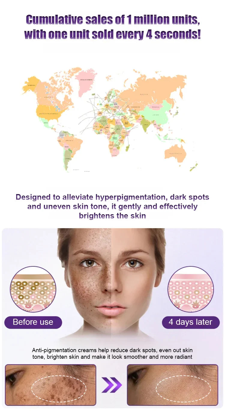 Fade the Look of Freckles & Dark Spots for a Brighter, More Even Glow